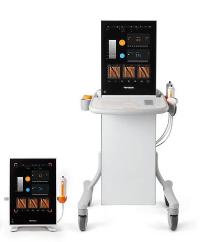 fibroscan